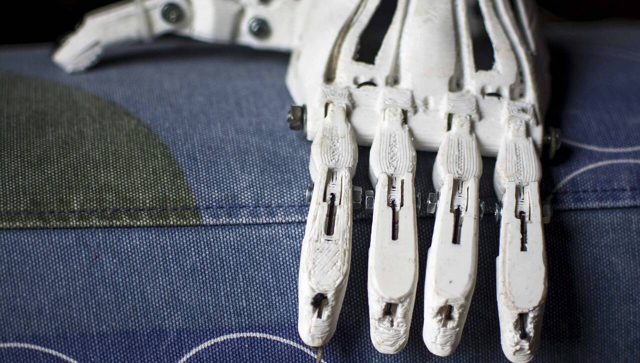 splotramienny-prostetic-1273178_1920